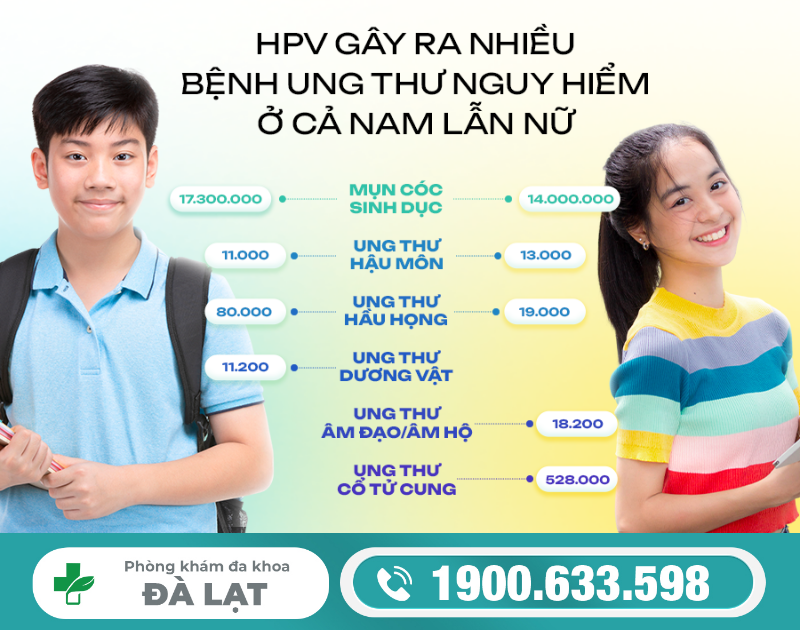 Hình ảnh minh họa